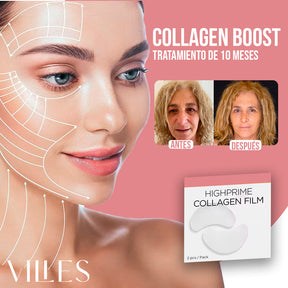 Collagen Boost® - Colágeno + Ácido Hialurónico [ACTIVOS DE BOTOX]