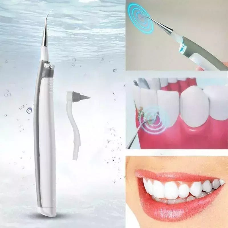 ClearSmile Pro® - El secreto para un perfecto sorisso